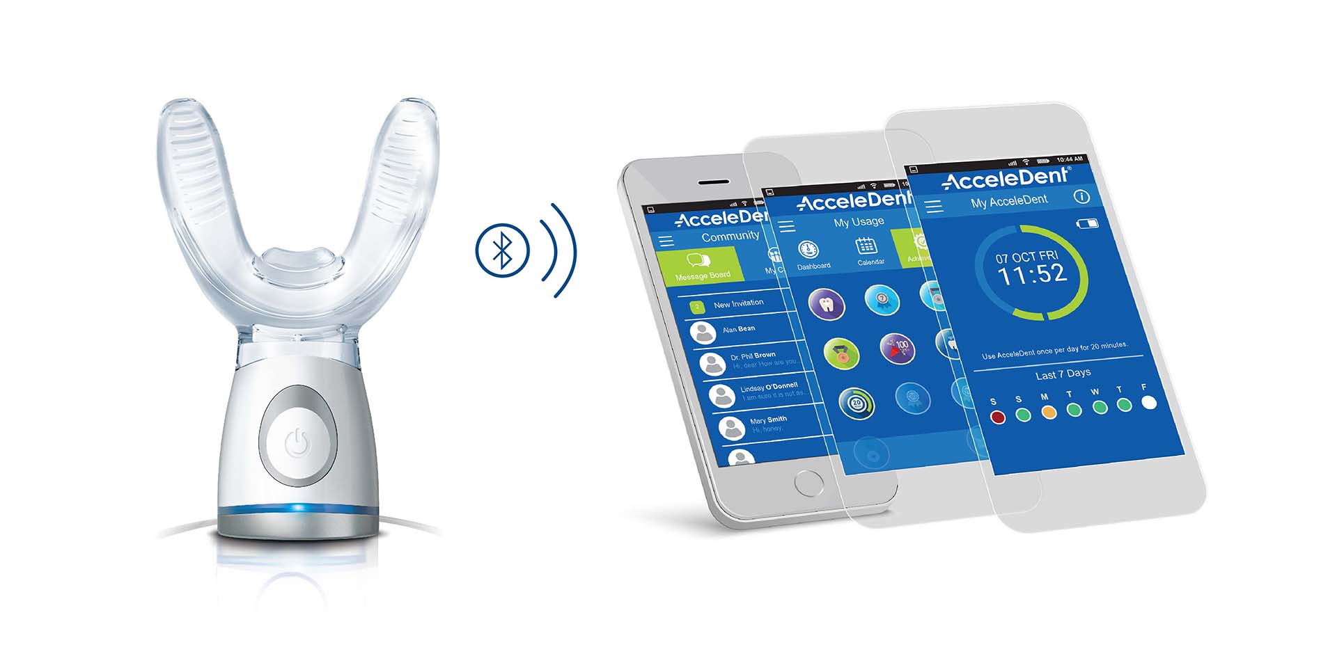 AcceleDent Optima device with mobile app