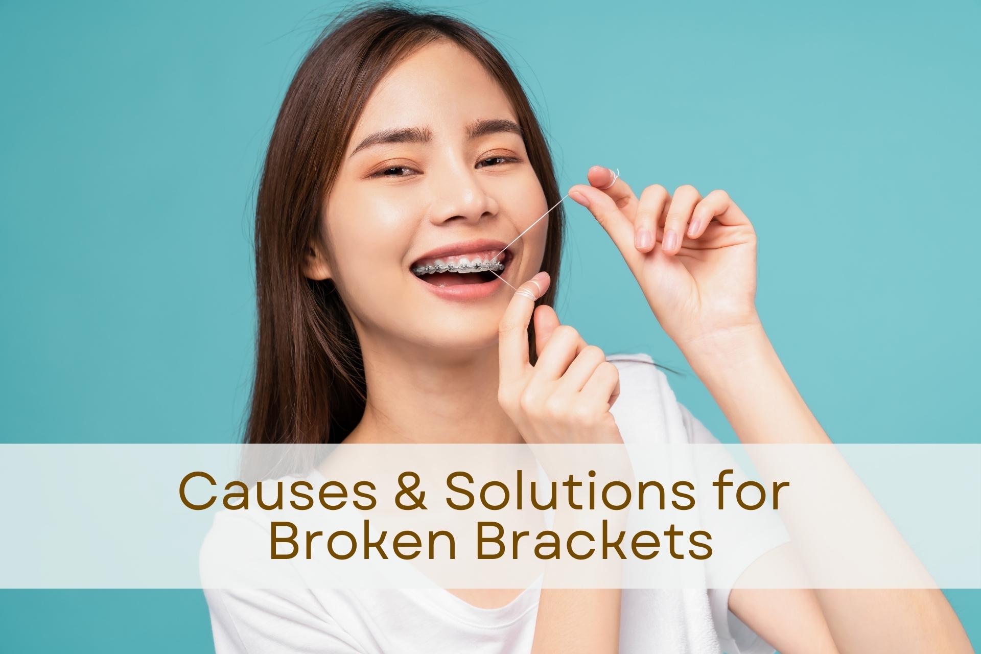 Common Causes of Broken Brackets