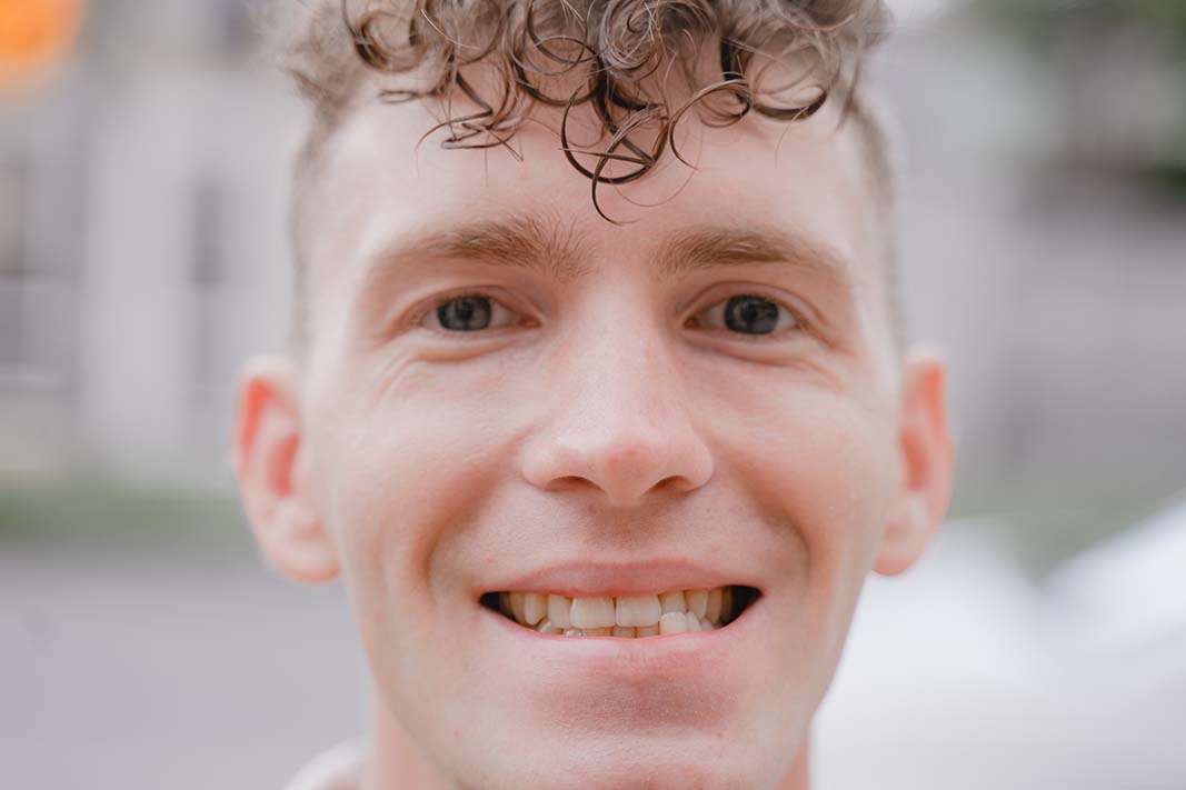 A Chicago man with curly hair smiling which shows his teeth are in cross bite