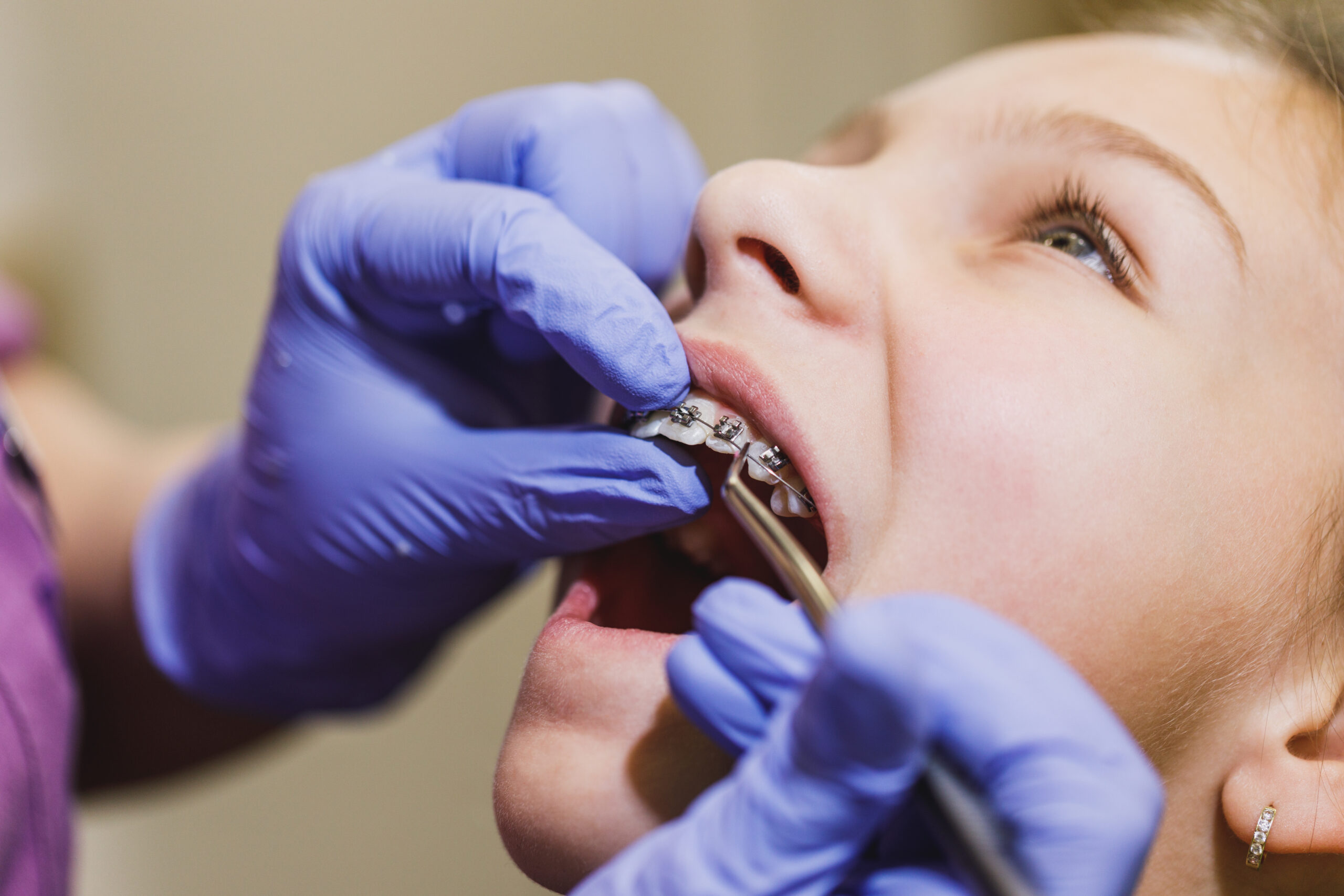 Child with braces going through airway focused orthodontic treatment