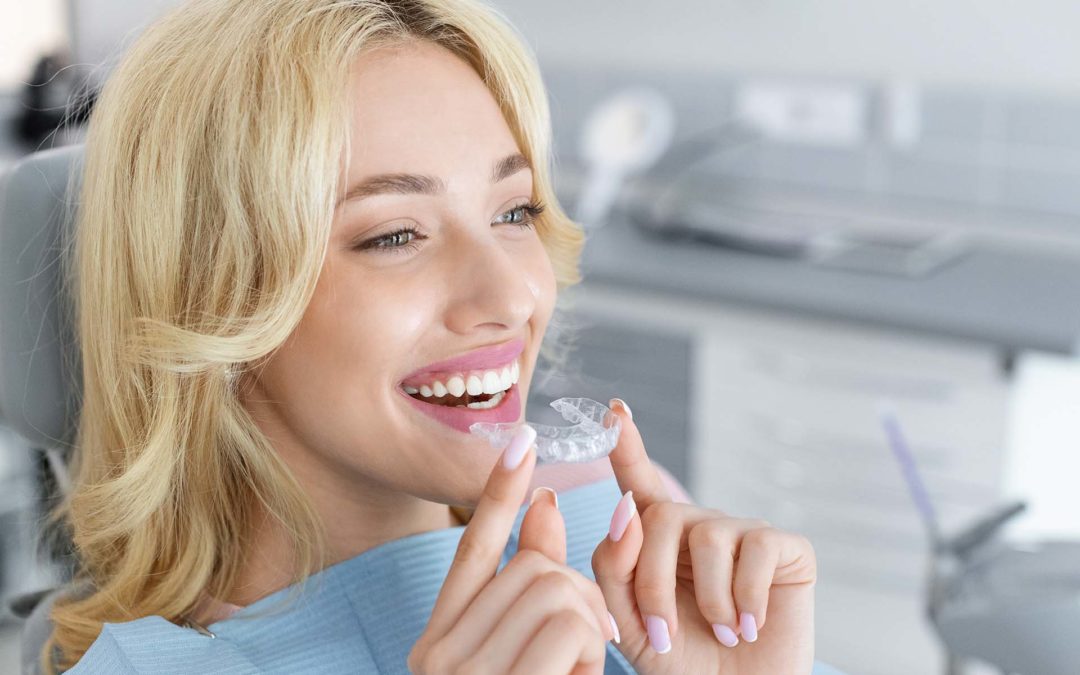 What to Know About Retainers